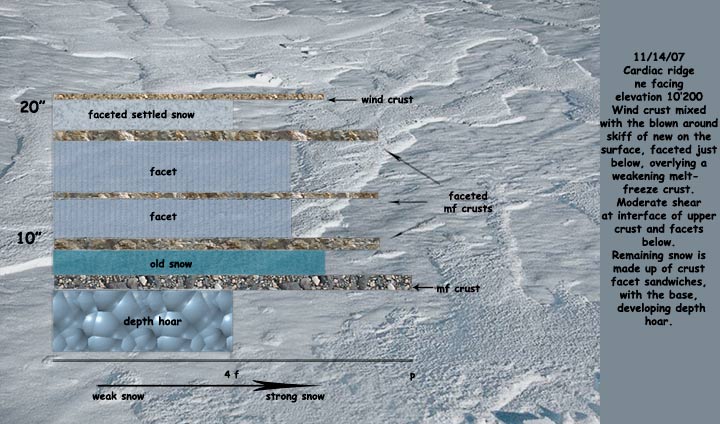 cardiac pit profile